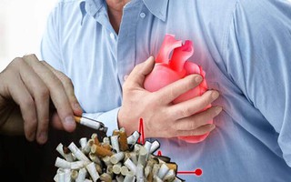 Sử dụng thuốc lá gây ra hơn 100.000 ca tử vong mỗi năm tại Việt Nam