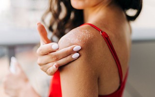 Cảnh báo dấu hiệu dị ứng kem chống nắng nghiêm trọng cần đi khám bác sĩ càng sớm càng tốt