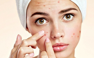 Nguy cơ tử vong từ thói quen tự nặn mụn