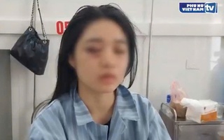 Hưng Yên: Một nữ sinh phải nhập viện cấp cứu vì bị đánh hội đồng