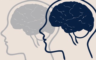 Tham vọng "chỉnh sửa não người" để điều trị bệnh thần kinh