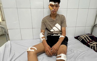 Quái xế "thông chốt" tông vào Cảnh sát cơ động có thể lĩnh án tới 20 năm tù?