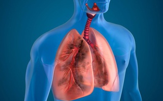 Các phương pháp xét nghiệm kiểm tra chức năng phổi phổ biến nhất hiện nay