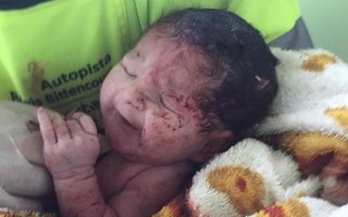 Em bé văng khỏi bụng mẹ sống sót kỳ diệu sau tai nạn kinh hoàng