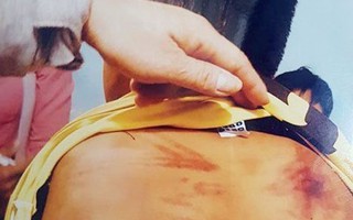 Bình Thuận: Bé trai nghi bị bạo hành sau khi tham dự 'khóa tu'