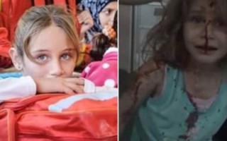 Tiếng gọi 'Cha ơi' xé lòng của bé gái Syria bị thương đẫm máu