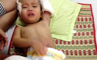 Tết bệnh viện của bé 3 tuổi bị xe ben cán