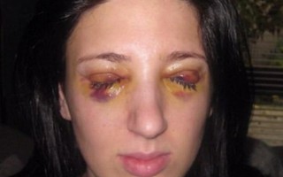 Người phụ nữ suốt 13 năm nhắm mắt 3 ngày, mở mắt 3 ngày
