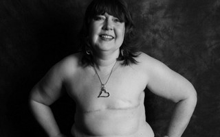 14 phụ nữ phơi ngực trần đầy sẹo để nâng cao nhận thức về ung thư vú