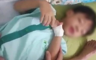 Bé 5 tuổi ở Quảng Nam tử vong sau khi bị chó cắn không phải do bệnh dại