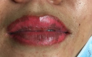 Đâm người tại cơ sở thẩm mỹ vì bạn gái làm môi bị hỏng