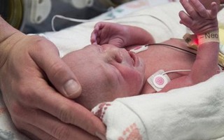 Em bé đầu tiên ở Mỹ ra đời từ bà mẹ được ghép tử cung
