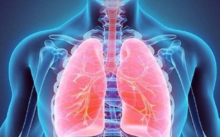 ‘Vì lá phổi khỏe’ nâng chất lượng sức khỏe bệnh nhân hen và bệnh phổi tắc nghẽn mạn tính 