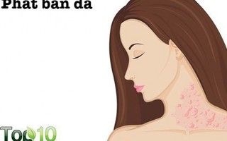 Dấu hiệu cảnh báo ngộ độc nấm mốc mà bạn nên biết