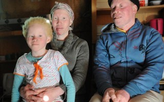 Gia đình bạch tạng Nam Phi sống trong sợ hãi vì nạn giết người chữa bệnh