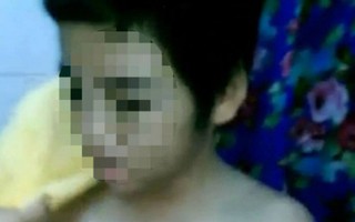 Bé trai 9 tuổi bị mẹ cùng bác họ bạo hành phải nhập viện