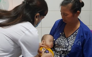 Không tiêm vaccine, cặp song sinh bị sởi biến chứng viêm phổi nguy kịch