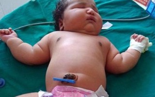 Bé gái sơ sinh 6,8kg nặng nhất thế giới
