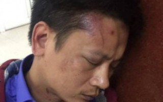 Người nhà bệnh nhân tố bị 3 bảo vệ BV phụ sản Hà Nội đánh trọng thương
