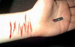 Không được đi du học, nữ sinh tự cắt 16 vết vào tay