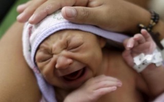 Chuyên gia bày cách phòng dị tật đầu nhỏ ở trẻ do Zika