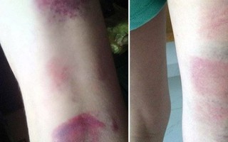 Lãnh đạo Sở GD&ĐT Bà Rịa - Vũng Tàu xin lỗi các học sinh bị cô giáo đánh 