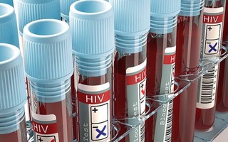Phát hiện phương pháp làm cho AIDS 'hết truyền nhiễm'