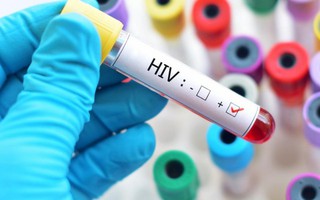 Phao cứu sinh nào cho người nhiễm HIV khi không còn miễn phí ARV?