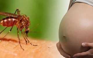 Không hạn chế khách du lịch mặc dù phát hiện 2 trường hợp nhiễm zika 