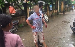 Thảm án ở Hà Nội: Nghi phạm đối diện mức án nào?