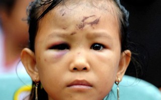 Những đứa trẻ vô gia cư sau động đất ở Indonesia