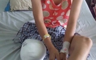 Sở Y tế Đắk Lắk thừa nhận sai sót khiến nữ sinh phải cưa chân