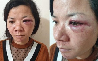 Chồng đánh vợ đêm mùng 2 Tết: Không phải lần đầu bạo hành