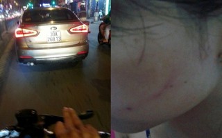 Cô gái bị bạt tai giữa phố đúng ngày 'xóa bỏ bạo lực với phụ nữ'