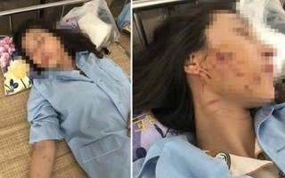 Vụ đổ nước mắm ớt lên người cô gái trẻ ở Thanh Hóa: Nạn nhân lên tiếng
