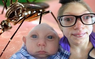 Phụ nữ nhiễm Zika tại Nhật không phải người Việt Nam