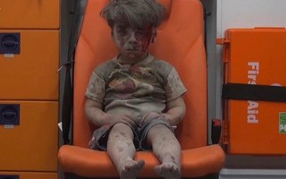 Cậu bé Syria bê bết máu khiến thế giới rơi lệ