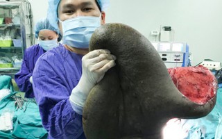 26 năm mang "mai rùa" khổng lồ trên lưng