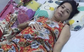 Nữ hành khách đi xe Phương Trang bị tai nạn phải cưa 1 chân, trách nhiệm bồi thường thế nào?