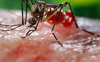 Các mẫu xét nghiệm zika ở VN đều âm tính