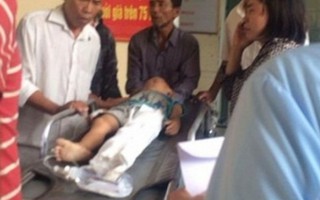 Bé trai 5 tuổi bị cột điện đè nát chân