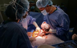 Kịp thời cứu bé sơ sinh lòi nội tạng ra ngoài