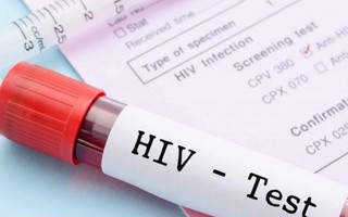Quy trình xét nghiệm khẳng định nhiễm HIV thế nào?
