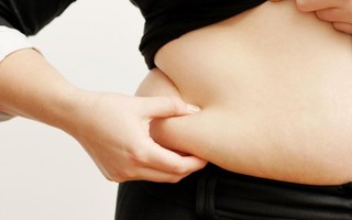 5 nguyên nhân dẫn đến tích tụ mỡ thừa ở phụ nữ