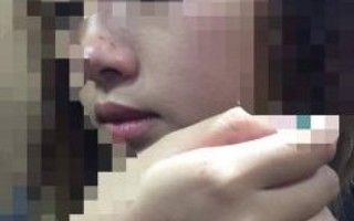 Nữ sinh bị cưỡng hôn trong thang máy ở Hà Nội đề nghị xử lý nghiêm kẻ quấy rối