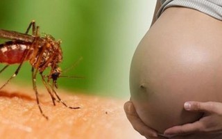 Gần 250 người ở Singapore nhiễm virus Zika: Bệnh đang đe dọa Việt Nam