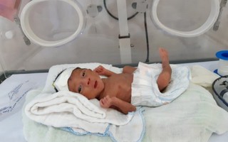 Bệnh viện đa khoa tuyến huyện cứu sống trẻ sinh non nặng 900g