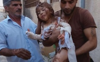 Chấn động hình ảnh em bé Napalm Syria