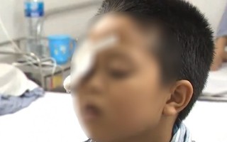 Sử dụng thuốc theo đơn cũ, bé 7 tuổi suýt mù mắt
