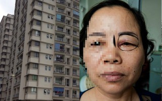 Hà Nội: Thêm một vụ nhân viên vệ sinh bị đấm tím mắt
